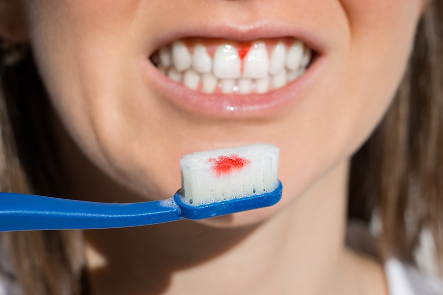 Emergency Dentistry