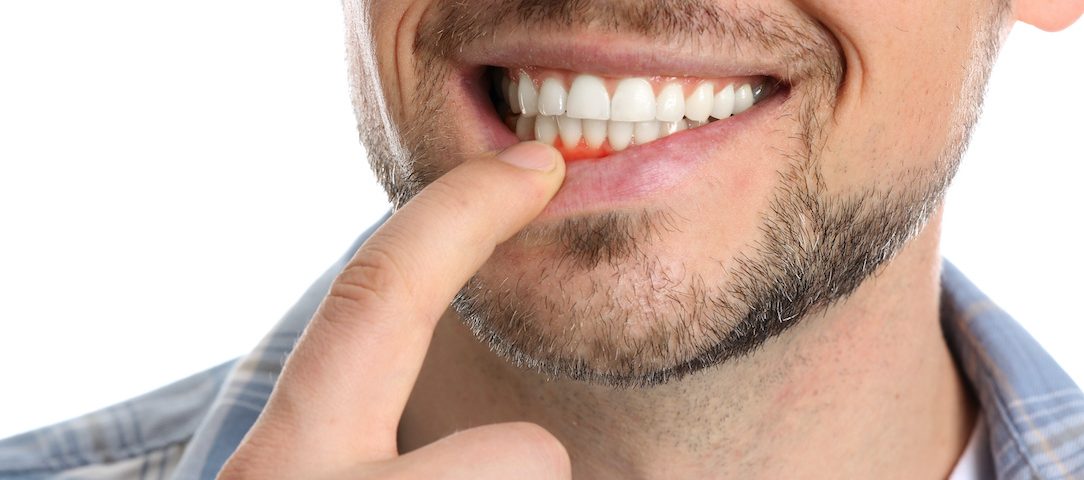 Oral Surgery
