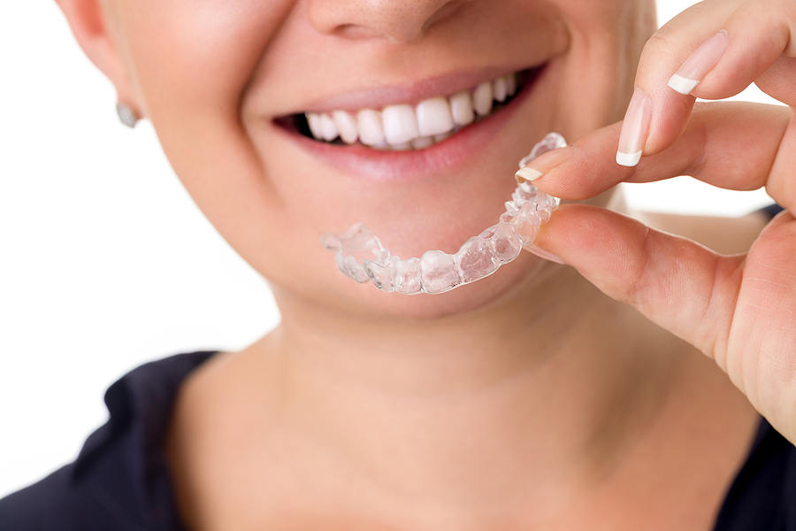 FAQ About Orthodontic Treatments