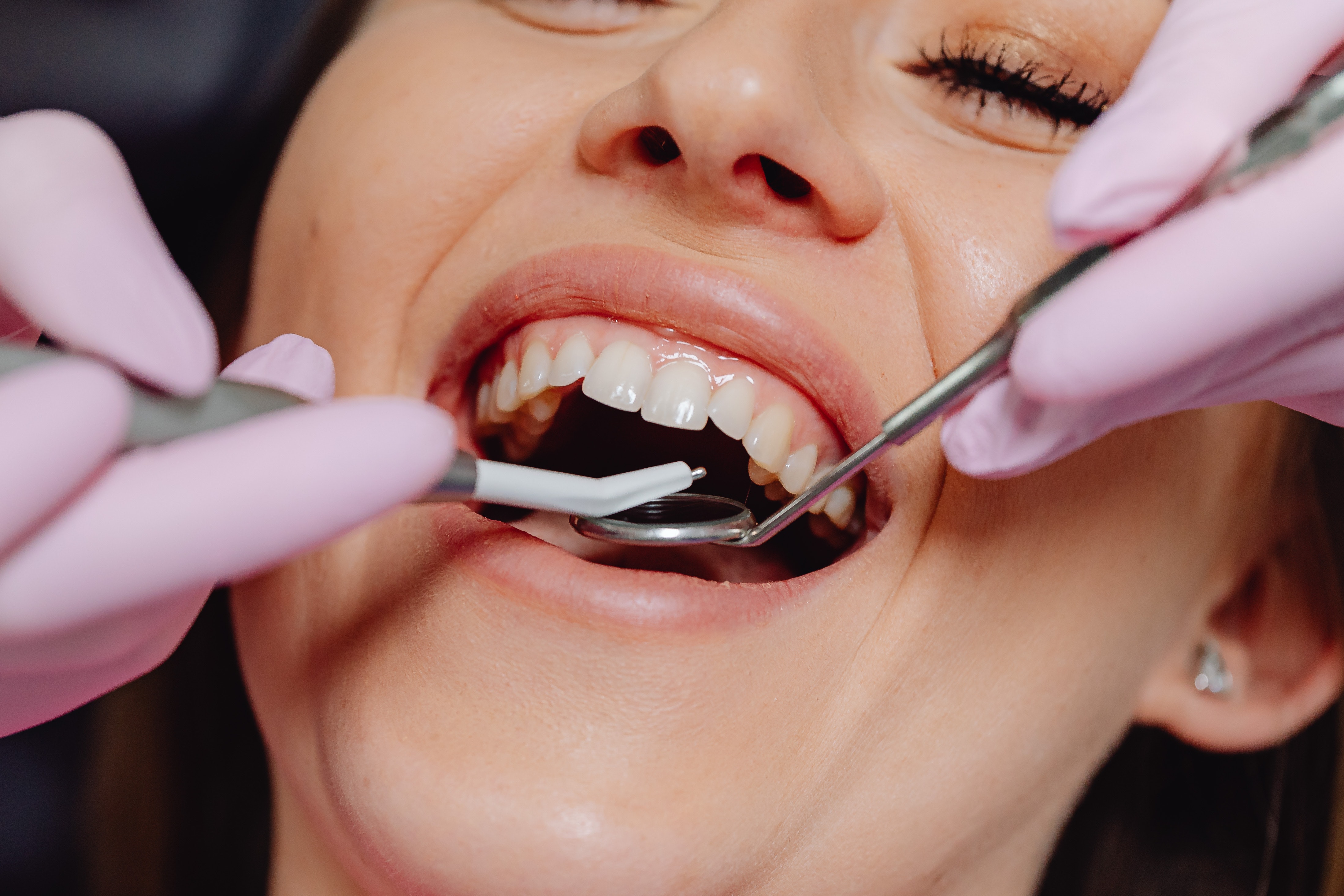 Preventative Dentistry